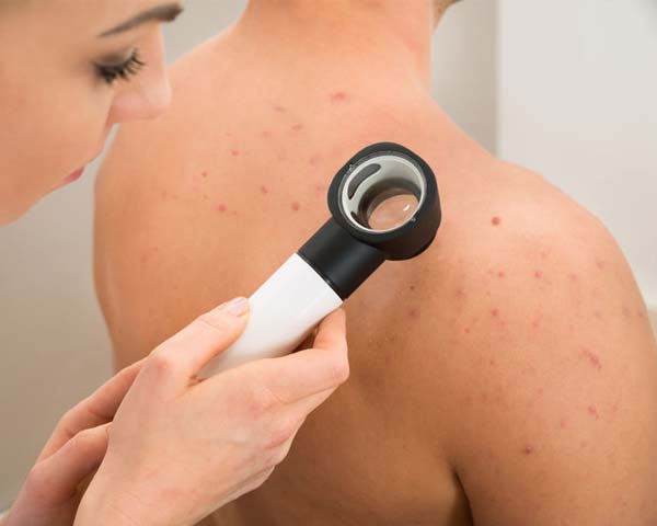 promo_images_600x480_skin_irregularities
