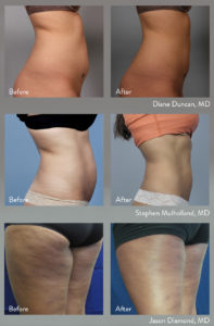 BodyFX_Lifestyle-AD-pics-only-197x300